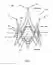 Fig. 04 - Catheter delivery system for heart valve prosthesis