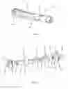 Fig. 13 - Catheter delivery system for heart valve prosthesis