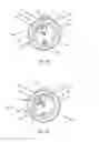 Fig. 15 - Catheter delivery system for heart valve prosthesis