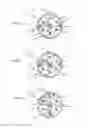 Fig. 16 - Catheter delivery system for heart valve prosthesis