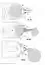 Fig. 08 - APPARATUS AND METHOD FOR BREAST RECONSTRUCTION AND AUGMENTATION USING AN AUTOLOGOUS PLATELET-RICH FIBRIN MATRIX