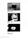 Fig. 04 - Nanostructured surfaces for biomedical/biomaterial applications and processes thereof