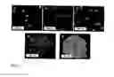 Fig. 08 - Nanostructured surfaces for biomedical/biomaterial applications and processes thereof