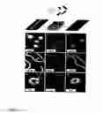 Fig. 09 - Nanostructured surfaces for biomedical/biomaterial applications and processes thereof