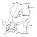 Fig. 01 - Method and apparatus for pre-forming a high tibial osteotomy