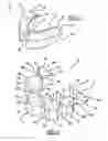 Fig. 03 - Method and apparatus for pre-forming a high tibial osteotomy