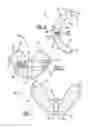 Fig. 04 - Method and apparatus for pre-forming a high tibial osteotomy