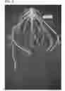 Fig. 04 - Compositions and methods for controlling nematodes