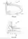 Fig. 05 - SELF-DONNING SURGICAL GOWN