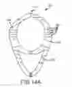 Fig. 15 - SELF-DONNING SURGICAL GOWN