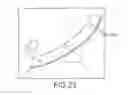 Fig. 23 - SELF-DONNING SURGICAL GOWN