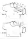 Fig. 03 - Medical gown
