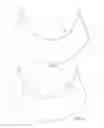 Fig. 03 - Winged Visor
