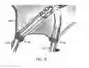 Fig. 05 - Self-tightening holding strap