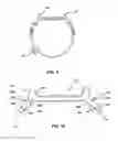 Fig. 06 - Armband for an electronic device