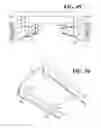 Fig. 35 - Table system