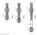 Fig. 03 - Method and apparatus for manipulating the side wall of a body lumen or body cavity so as to provide increased visualization of the same and/or increased access to the same, and/or for stabilizing instruments relative to the same