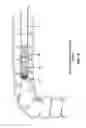 Fig. 17 - Method and apparatus for manipulating the side wall of a body lumen or body cavity so as to provide increased visualization of the same and/or increased access to the same, and/or for stabilizing instruments relative to the same
