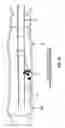 Fig. 26 - Method and apparatus for manipulating the side wall of a body lumen or body cavity so as to provide increased visualization of the same and/or increased access to the same, and/or for stabilizing instruments relative to the same