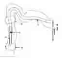 Fig. 28 - Method and apparatus for manipulating the side wall of a body lumen or body cavity so as to provide increased visualization of the same and/or increased access to the same, and/or for stabilizing instruments relative to the same