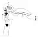 Fig. 29 - Method and apparatus for manipulating the side wall of a body lumen or body cavity so as to provide increased visualization of the same and/or increased access to the same, and/or for stabilizing instruments relative to the same