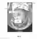 Fig. 06 - Digital colposcope system