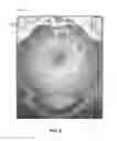 Fig. 07 - Digital colposcope system