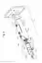 Fig. 03 - Method and Apparatuses for Hysteroscopy and Combined Hysteroscopy and Endometrial Biopsy