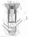 Fig. 04 - Method and Apparatuses for Hysteroscopy and Combined Hysteroscopy and Endometrial Biopsy