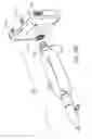 Fig. 17 - Method and Apparatuses for Hysteroscopy and Combined Hysteroscopy and Endometrial Biopsy