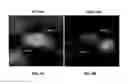 Fig. 06 - Optoacoustic-ultrasonic system for coregistered functional and morphological imaging of placentas