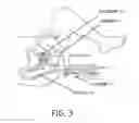 Fig. 04 - Three-dimensional optical imaging and therapy of prostate cancer