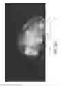 Fig. 06 - Three-dimensional optical imaging and therapy of prostate cancer