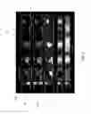 Fig. 08 - Detection of lipid core plaque cap thickness