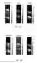 Fig. 22 - Systems and methods for real-time tracking of photoacoustic sensing