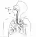 Fig. 01 - METHODS AND SYSTEMS FOR ENDOBRONCHIAL DIAGNOSIS AND TREATMENT