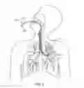 Fig. 03 - METHODS AND SYSTEMS FOR ENDOBRONCHIAL DIAGNOSIS AND TREATMENT
