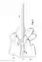 Fig. 05 - Expandable surgical instruments and methods of use and fabrication