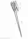 Fig. 07 - INTRAVASCULAR ELECTRODES AND ANCHORING DEVICES FOR TRANSVASCULAR STIMULATION