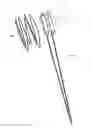 Fig. 09 - INTRAVASCULAR ELECTRODES AND ANCHORING DEVICES FOR TRANSVASCULAR STIMULATION