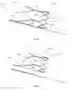 Fig. 14 - INTRAVASCULAR ELECTRODES AND ANCHORING DEVICES FOR TRANSVASCULAR STIMULATION