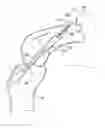 Fig. 01 - Tissue graft fixation