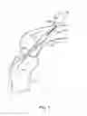 Fig. 02 - Tissue graft fixation