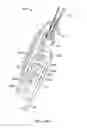 Fig. 04 - Tissue graft fixation