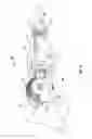 Fig. 13 - Multiple member interconnect for surgical instrument and absorbable screw fastener