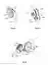 Fig. 53 - Multiple member interconnect for surgical instrument and absorbable screw fastener