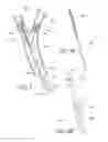 Fig. 04 - Method and apparatus for treating a carotid artery