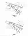 Fig. 05 - Surgical instrument with end-effector assembly including three jaw members