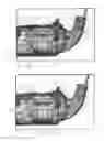 Fig. 35 - Devices and methods for cutting tissue