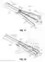 Fig. 09 - Surgical instrument with end-effector assembly including three jaw members